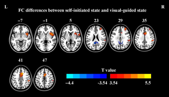 https://cdn.ncbi.nlm.nih.gov/pmc/blobs/7de8/9783468/09a4f216fd2b/HBM-44-203-g004.jpg