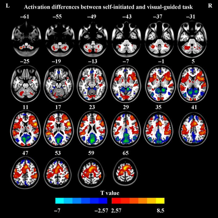 https://cdn.ncbi.nlm.nih.gov/pmc/blobs/7de8/9783468/111270fe9c1e/HBM-44-203-g008.jpg