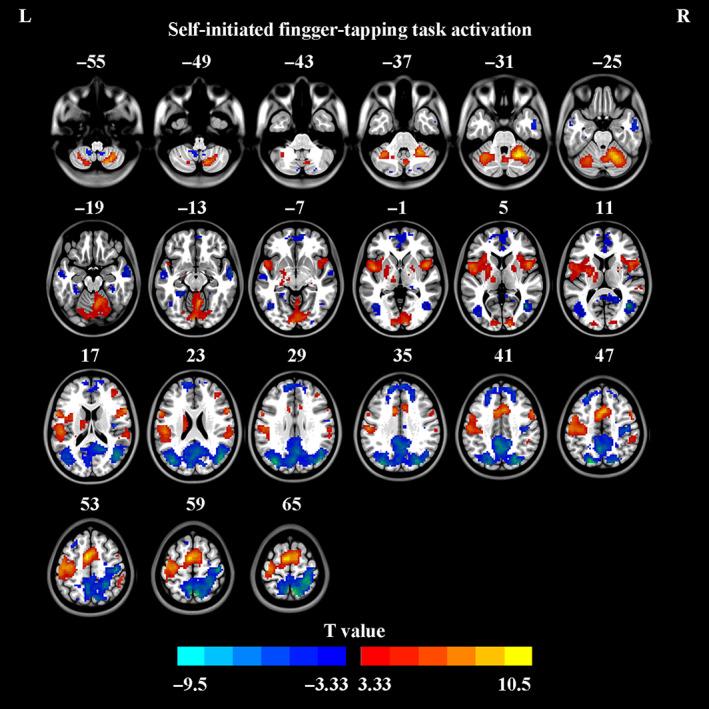 https://cdn.ncbi.nlm.nih.gov/pmc/blobs/7de8/9783468/3e0b4727a029/HBM-44-203-g002.jpg