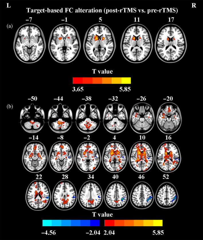 https://cdn.ncbi.nlm.nih.gov/pmc/blobs/7de8/9783468/3f4f48da6a52/HBM-44-203-g005.jpg