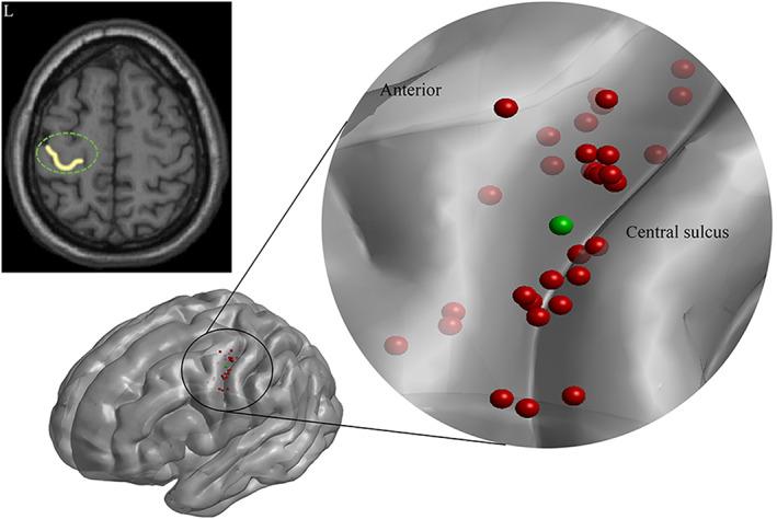 https://cdn.ncbi.nlm.nih.gov/pmc/blobs/7de8/9783468/cb16469dab7e/HBM-44-203-g006.jpg