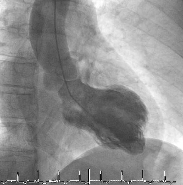 https://cdn.ncbi.nlm.nih.gov/pmc/blobs/7df1/2599899/40028d857c12/1757-1626-1-331-2.jpg