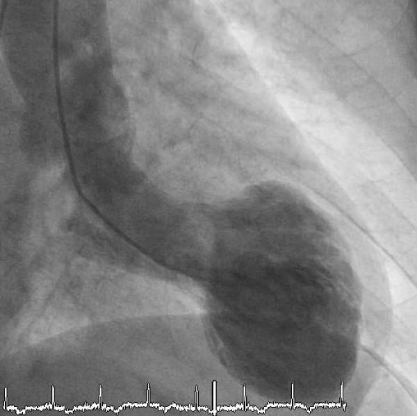 https://cdn.ncbi.nlm.nih.gov/pmc/blobs/7df1/2599899/e194fb955fbe/1757-1626-1-331-1.jpg