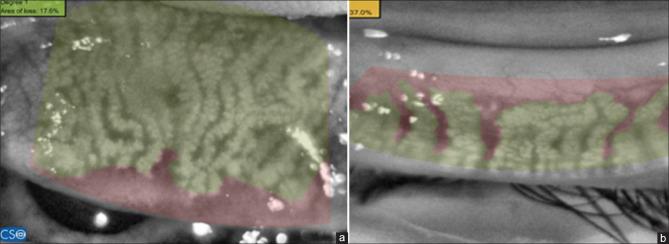 https://cdn.ncbi.nlm.nih.gov/pmc/blobs/7df4/9672791/130c894d9617/IJO-70-2922-g001.jpg
