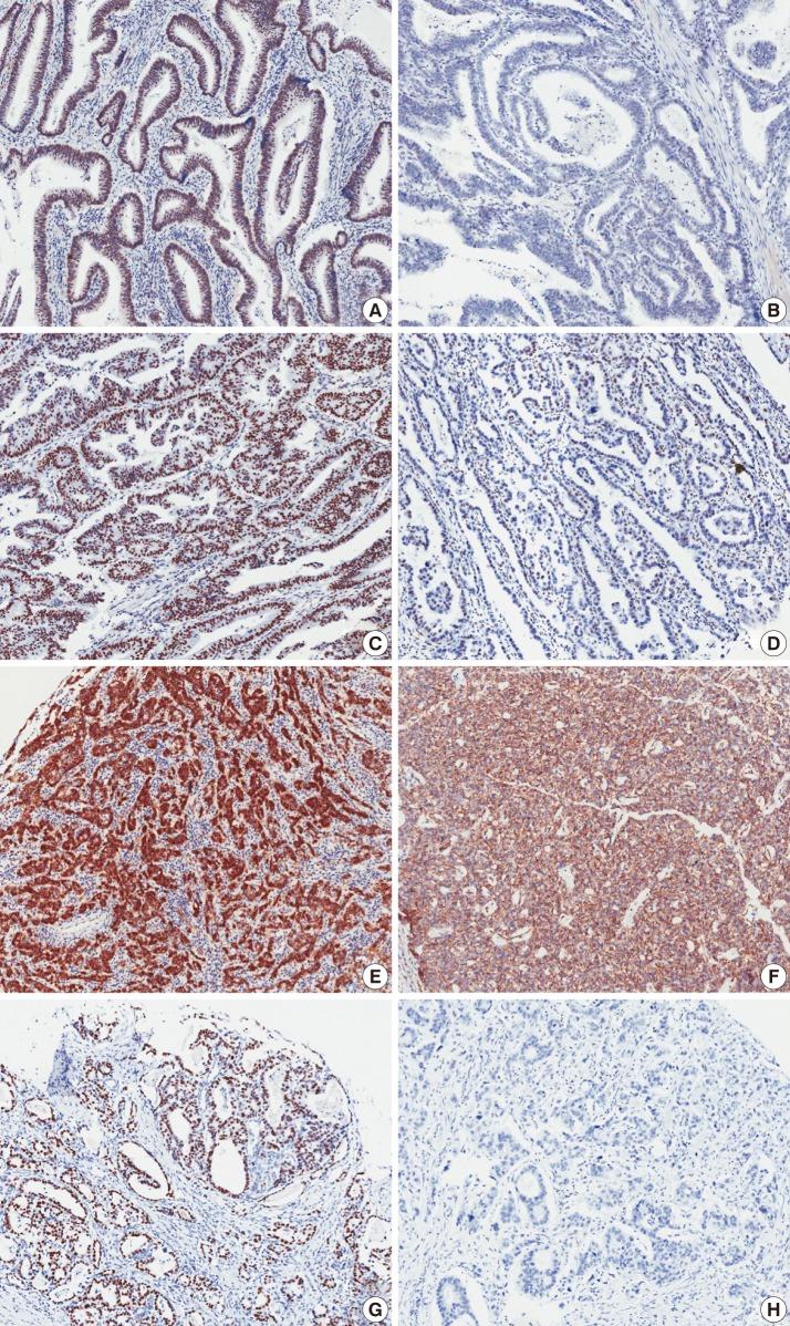https://cdn.ncbi.nlm.nih.gov/pmc/blobs/7df5/3540329/214c2e0d87eb/kjpathol-46-523-g001.jpg