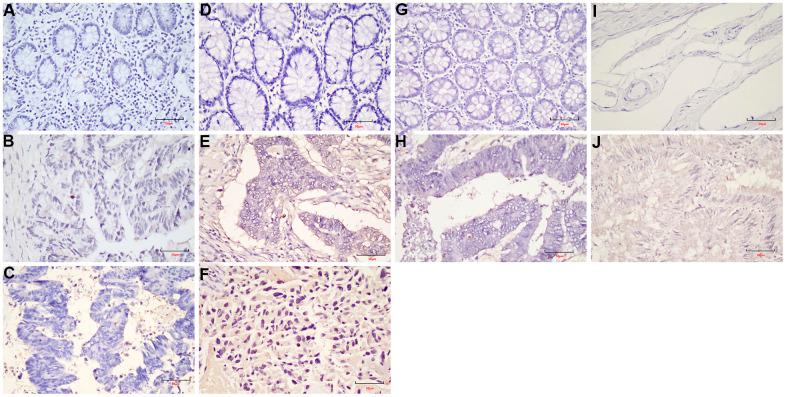 https://cdn.ncbi.nlm.nih.gov/pmc/blobs/7df6/8544332/65561c86006b/aging-13-203618-g009.jpg