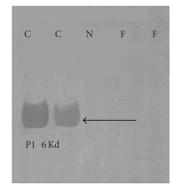 https://cdn.ncbi.nlm.nih.gov/pmc/blobs/7dfa/2778443/59882ac88889/IJE2009-687259.008.jpg