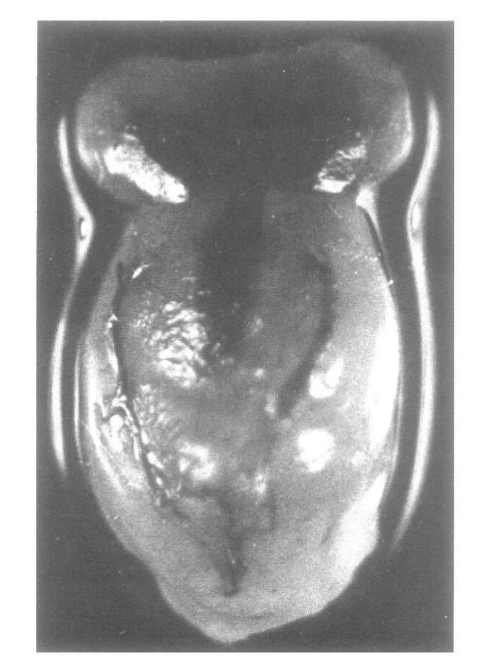 https://cdn.ncbi.nlm.nih.gov/pmc/blobs/7dfa/2778443/7b3a5411d59b/IJE2009-687259.001.jpg