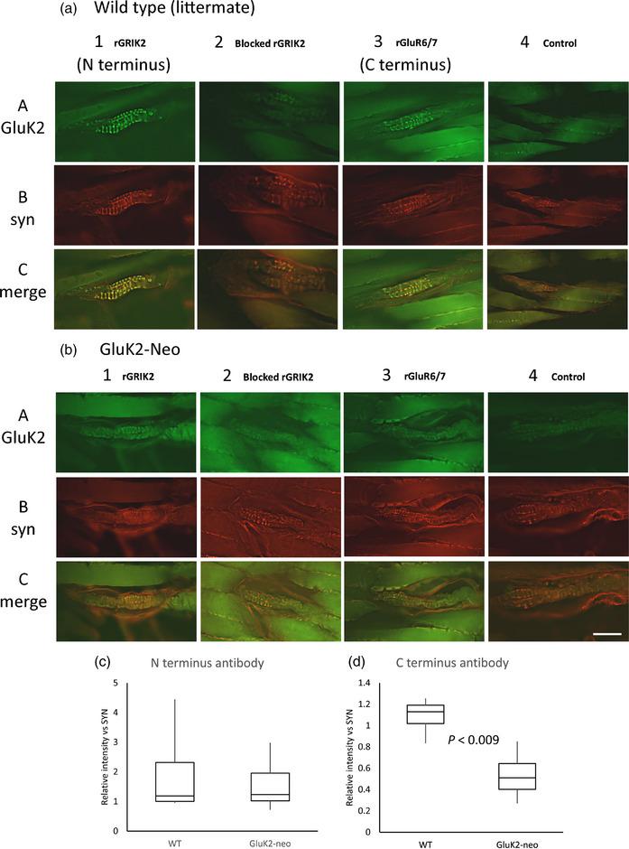 https://cdn.ncbi.nlm.nih.gov/pmc/blobs/7dfb/10988755/62c44bdc3765/EPH-109-81-g008.jpg