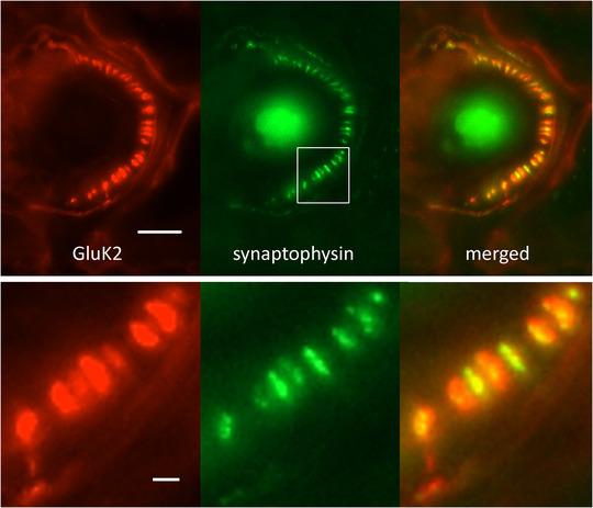 https://cdn.ncbi.nlm.nih.gov/pmc/blobs/7dfb/10988755/821420198511/EPH-109-81-g003.jpg