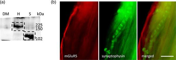 https://cdn.ncbi.nlm.nih.gov/pmc/blobs/7dfb/10988755/a17914fafb34/EPH-109-81-g004.jpg