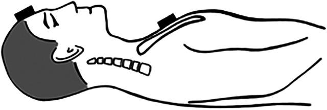 https://cdn.ncbi.nlm.nih.gov/pmc/blobs/7dfb/8202247/8665f5ae4b65/10.1177_21514593211021824-fig2.jpg