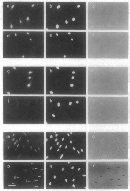 https://cdn.ncbi.nlm.nih.gov/pmc/blobs/7dfc/45667/e394315b2e58/pnas01100-0035-a.jpg