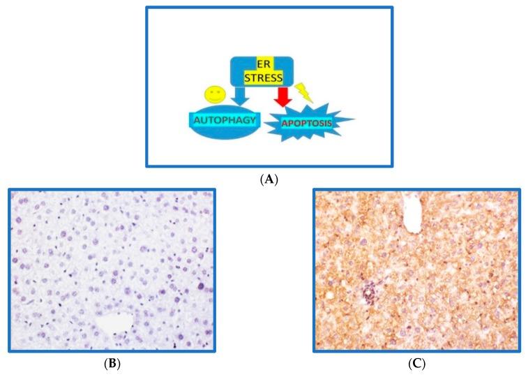 https://cdn.ncbi.nlm.nih.gov/pmc/blobs/7e02/6562650/acb9794ffab5/cells-08-00408-g002.jpg