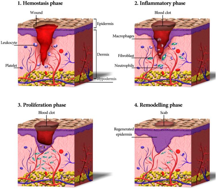 https://cdn.ncbi.nlm.nih.gov/pmc/blobs/7e03/9309282/aa3af5b29d63/IJN-17-3125-g0001.jpg