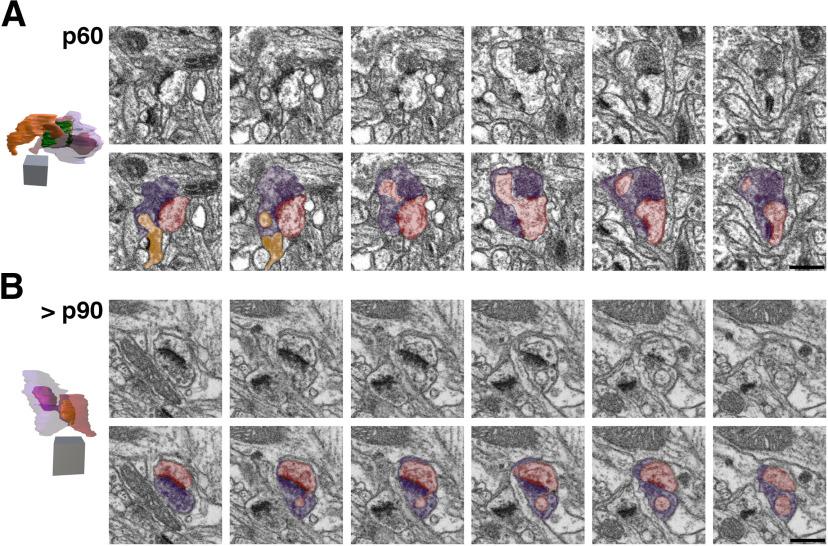 https://cdn.ncbi.nlm.nih.gov/pmc/blobs/7e0f/7568603/d704a377966f/SN-ENUJ200253F004.jpg
