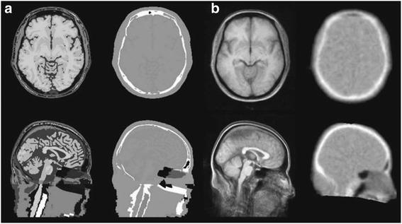 https://cdn.ncbi.nlm.nih.gov/pmc/blobs/7e10/6015803/6ac475979ac9/41824_2018_30_Fig9_HTML.jpg