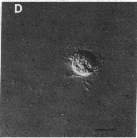https://cdn.ncbi.nlm.nih.gov/pmc/blobs/7e11/391612/c9958c78ba05/pnas00616-0354-c.jpg