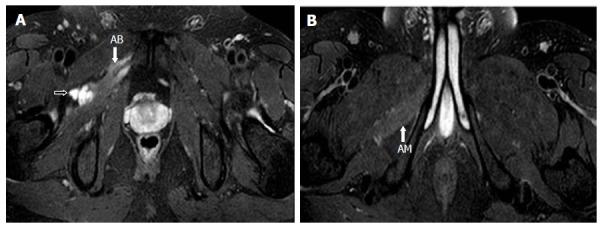 https://cdn.ncbi.nlm.nih.gov/pmc/blobs/7e14/5441458/73d0d3189255/WJR-9-230-g008.jpg