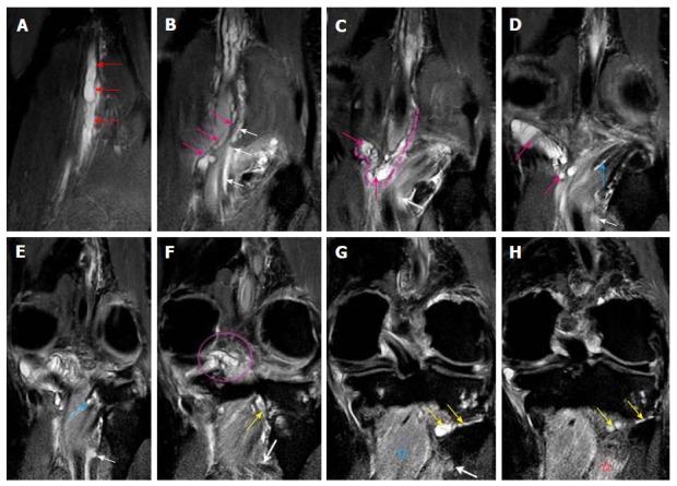 https://cdn.ncbi.nlm.nih.gov/pmc/blobs/7e14/5441458/7abd0693a317/WJR-9-230-g004.jpg