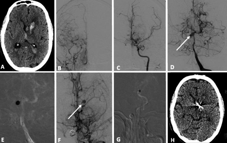 https://cdn.ncbi.nlm.nih.gov/pmc/blobs/7e17/10867726/9568c2dc089c/cureus-0016-00000052370-i02.jpg