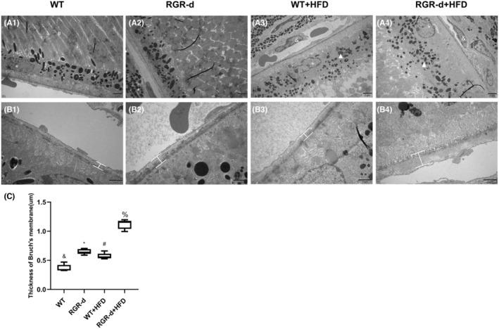 https://cdn.ncbi.nlm.nih.gov/pmc/blobs/7e27/11580724/a565ebac22c6/FSB2-38-e70135-g009.jpg
