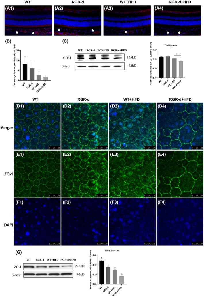 https://cdn.ncbi.nlm.nih.gov/pmc/blobs/7e27/11580724/c34320c603ab/FSB2-38-e70135-g008.jpg