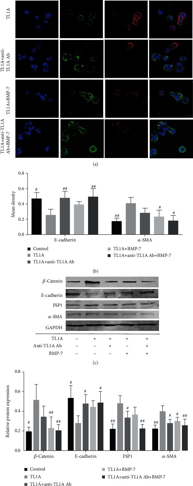 https://cdn.ncbi.nlm.nih.gov/pmc/blobs/7e2b/8253633/2b90cfcc6c5e/MI2021-5927064.007.jpg