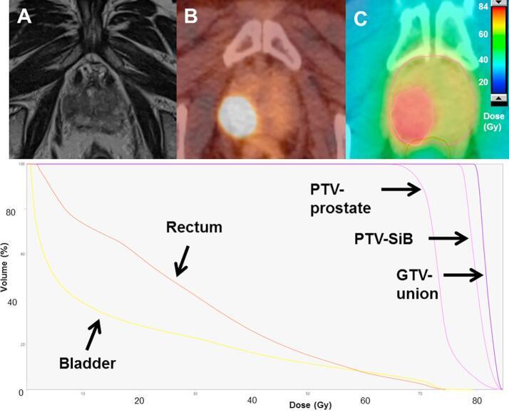 https://cdn.ncbi.nlm.nih.gov/pmc/blobs/7e2c/7807571/365db197ab51/gr2.jpg