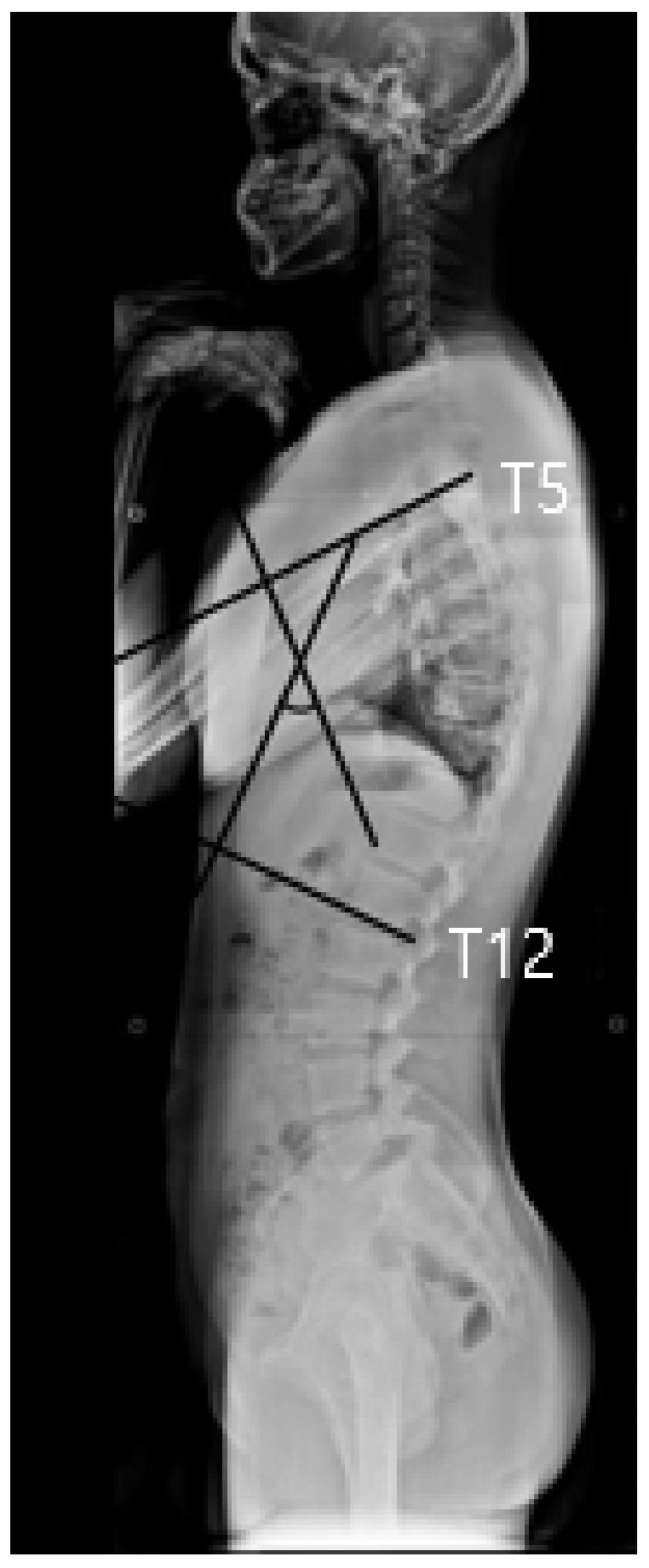https://cdn.ncbi.nlm.nih.gov/pmc/blobs/7e39/9776914/40df187b5a96/children-09-01999-g001.jpg