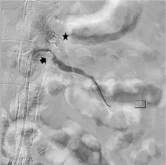 https://cdn.ncbi.nlm.nih.gov/pmc/blobs/7e41/5843098/148a65fde058/10.1177_1179547618761378-fig3.jpg