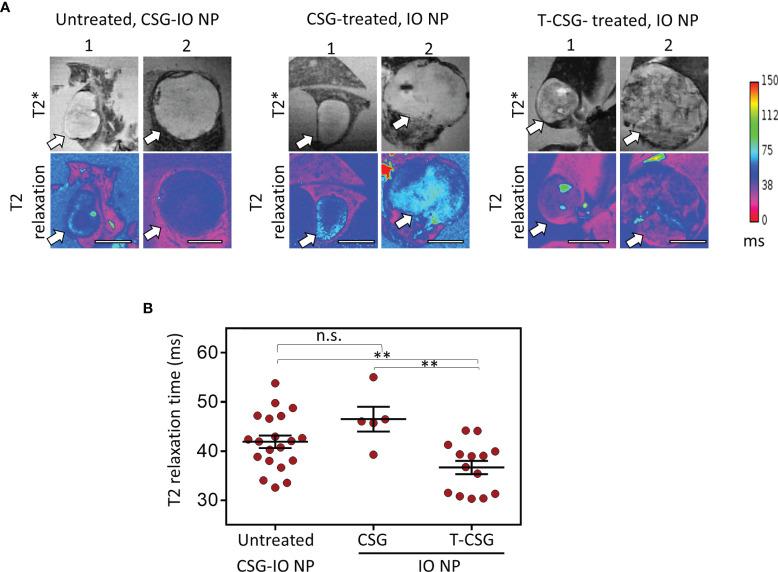 https://cdn.ncbi.nlm.nih.gov/pmc/blobs/7e42/8902243/8537c9521721/fonc-12-837234-g003.jpg