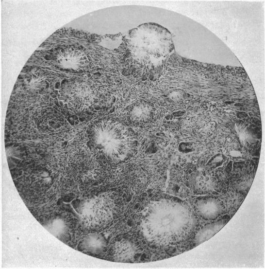 https://cdn.ncbi.nlm.nih.gov/pmc/blobs/7e4a/1400400/c7d425eebd87/annsurg00700-0005-a.jpg