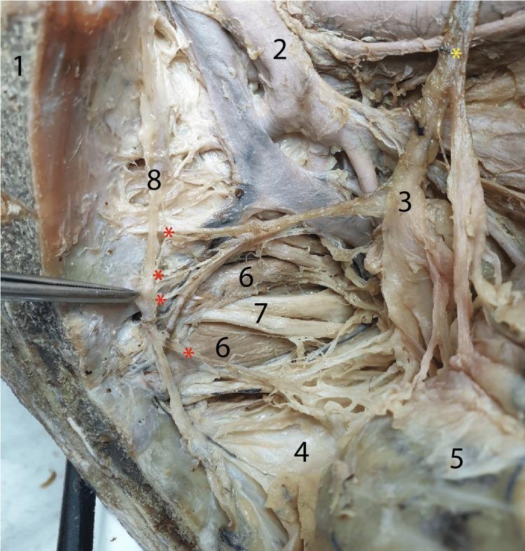 https://cdn.ncbi.nlm.nih.gov/pmc/blobs/7e4f/11466058/82911f0502c7/cureus-0016-00000069091-i05.jpg