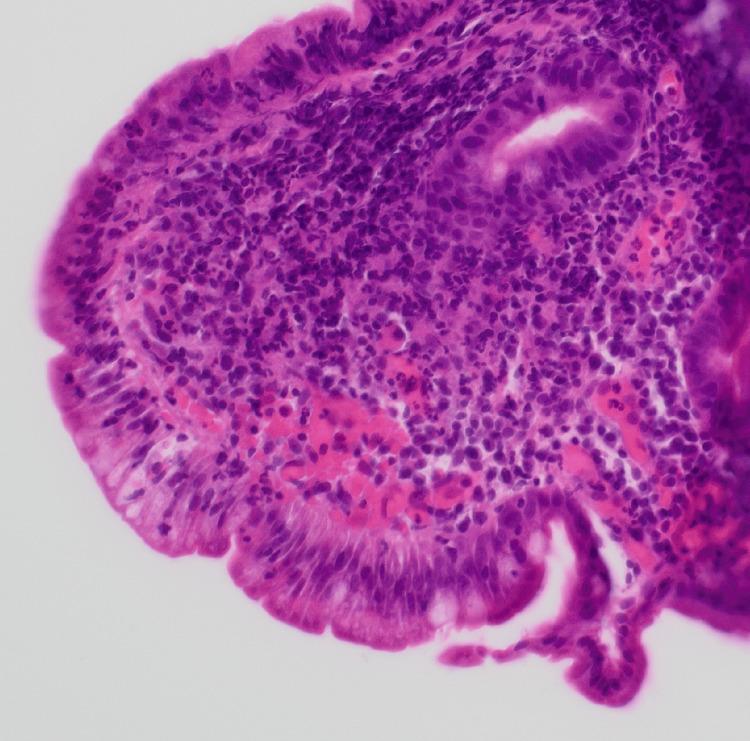 https://cdn.ncbi.nlm.nih.gov/pmc/blobs/7e4f/12079158/26fb11a53ee9/cureus-0017-00000082221-i07.jpg