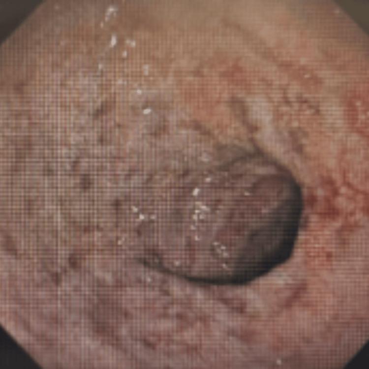 https://cdn.ncbi.nlm.nih.gov/pmc/blobs/7e4f/12079158/3d1a50365f0e/cureus-0017-00000082221-i04.jpg