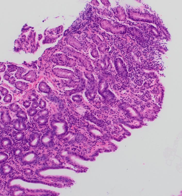 https://cdn.ncbi.nlm.nih.gov/pmc/blobs/7e4f/12079158/df9df3fed6aa/cureus-0017-00000082221-i05.jpg