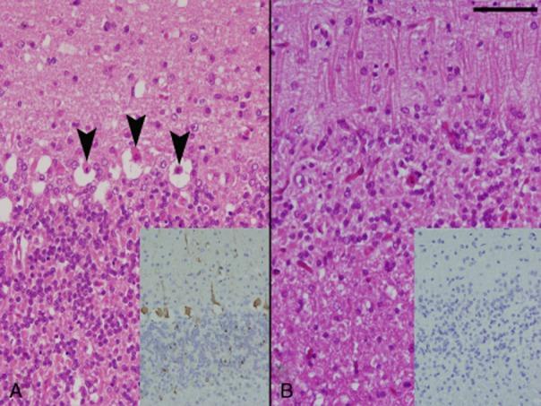 https://cdn.ncbi.nlm.nih.gov/pmc/blobs/7e58/4235457/d6d410bc6f11/neup0034-0277-f4.jpg