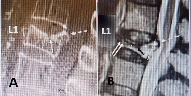 https://cdn.ncbi.nlm.nih.gov/pmc/blobs/7e59/7954647/f3d8b748e50a/cureus-0013-00000013839-i01.jpg