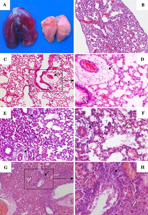 https://cdn.ncbi.nlm.nih.gov/pmc/blobs/7e5b/7101852/b6bf2597d238/705_2009_560_Fig1_HTML.jpg