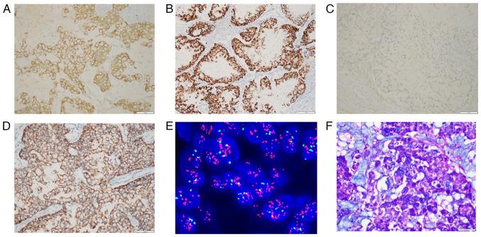 https://cdn.ncbi.nlm.nih.gov/pmc/blobs/7e5c/12030918/755ac87ca518/ol-29-06-15050-g01.jpg