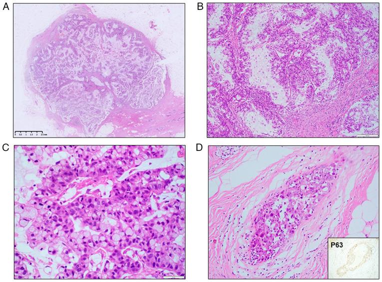 https://cdn.ncbi.nlm.nih.gov/pmc/blobs/7e5c/12030918/795a1e71a95f/ol-29-06-15050-g00.jpg