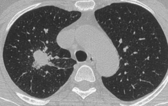 https://cdn.ncbi.nlm.nih.gov/pmc/blobs/7e5f/2254641/669840c873b8/1752-1947-2-21-1.jpg