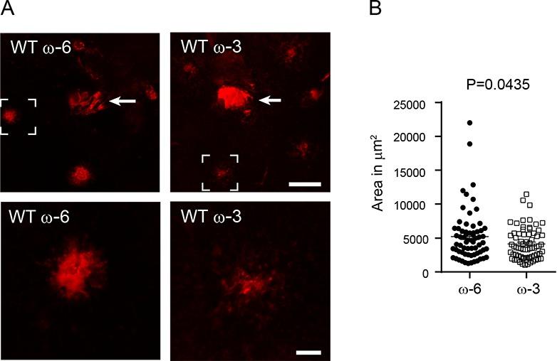 https://cdn.ncbi.nlm.nih.gov/pmc/blobs/7e60/5539800/1b454c40834b/i1552-5783-58-10-3862-f01.jpg