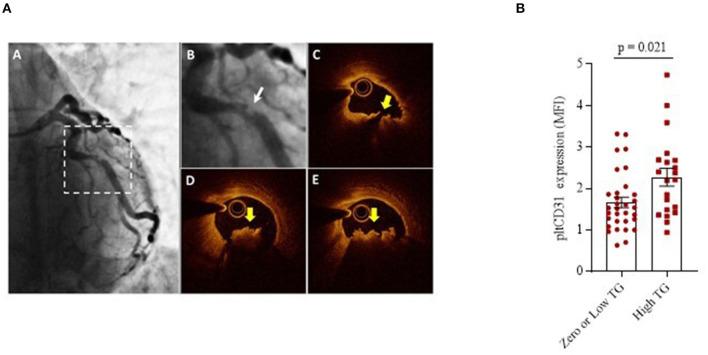 https://cdn.ncbi.nlm.nih.gov/pmc/blobs/7e64/8821091/be60fb237581/fcvm-08-741221-g0005.jpg