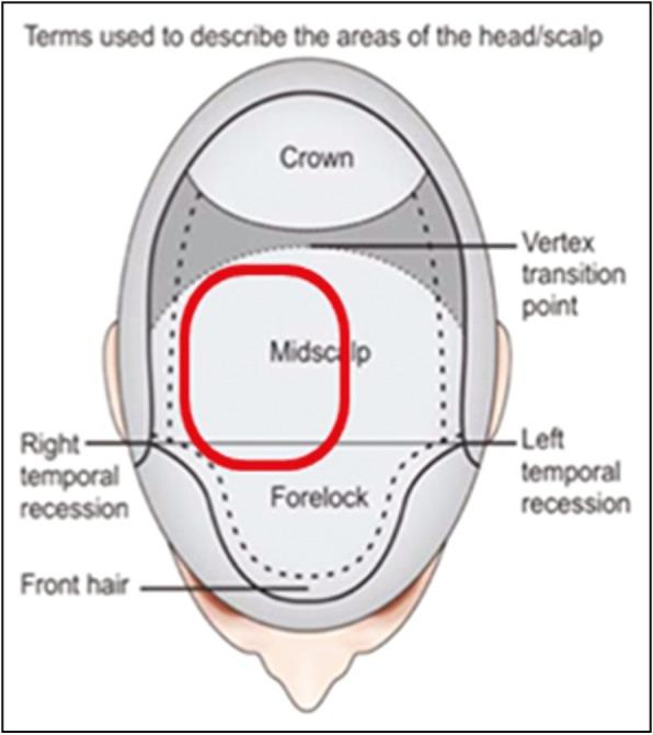 https://cdn.ncbi.nlm.nih.gov/pmc/blobs/7e6b/6371721/d2807b7c5b56/JCAS-11-202-g001.jpg