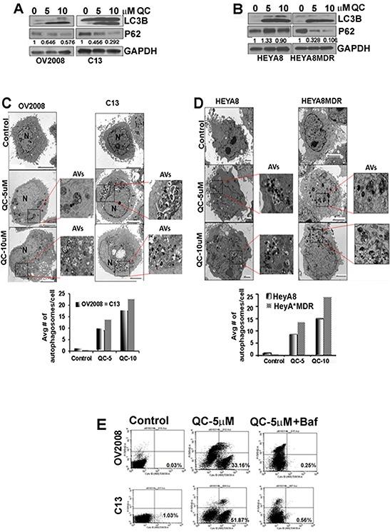 https://cdn.ncbi.nlm.nih.gov/pmc/blobs/7e77/4742182/cdcfbbb2fe7e/oncotarget-06-36354-g002.jpg