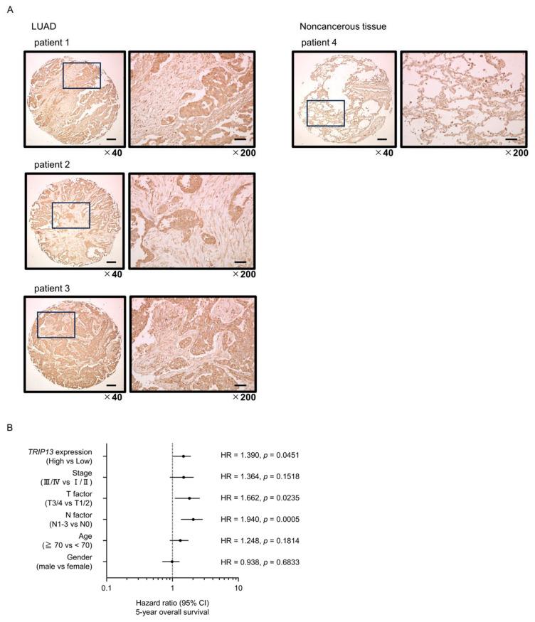 https://cdn.ncbi.nlm.nih.gov/pmc/blobs/7e7a/10705761/2bdbf83a3e0b/cancers-15-05571-g007a.jpg