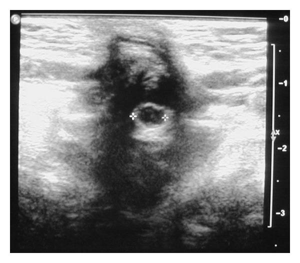 https://cdn.ncbi.nlm.nih.gov/pmc/blobs/7e84/3368171/8ce7ce538093/CRIM.PEDIATRICS2012-482185.001.jpg