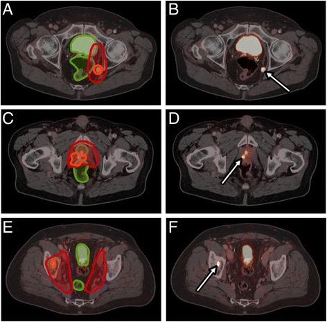 https://cdn.ncbi.nlm.nih.gov/pmc/blobs/7e8c/5681820/194e2b073d39/13014_2017_902_Fig4_HTML.jpg